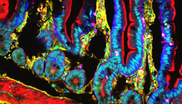 Image confocale du système immunitaire des cellules du petit intestin